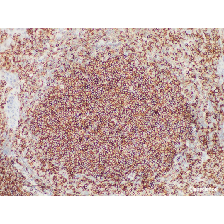 Validation Data - Anti-CD45 (LCA) Antibody [YN00375m] (A288711)