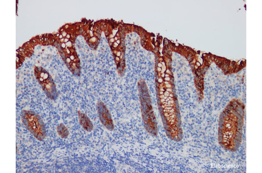 Validation Data - Anti-CEA Antibody [YN00175m] (A288712)