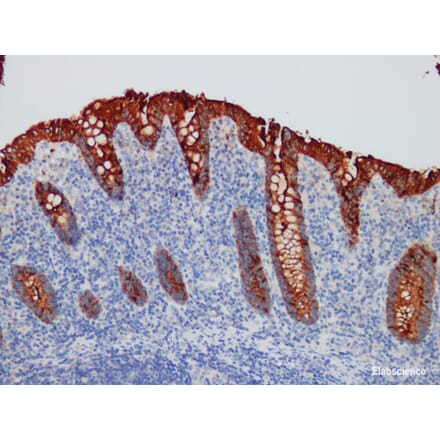 Validation Data - Anti-CEA Antibody [YN00175m] (A288712)