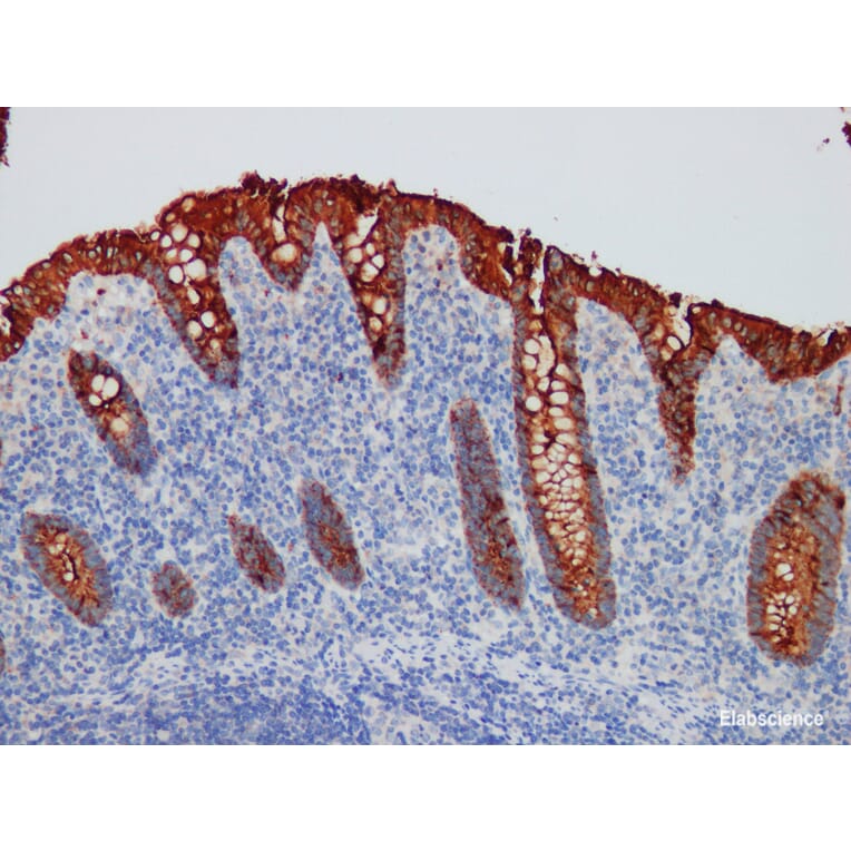 Validation Data - Anti-CEA Antibody [YN00175m] (A288712)