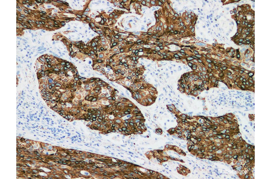 Validation Data - Anti-Cytokeratin 15 Antibody [YN00666m] (A288713)