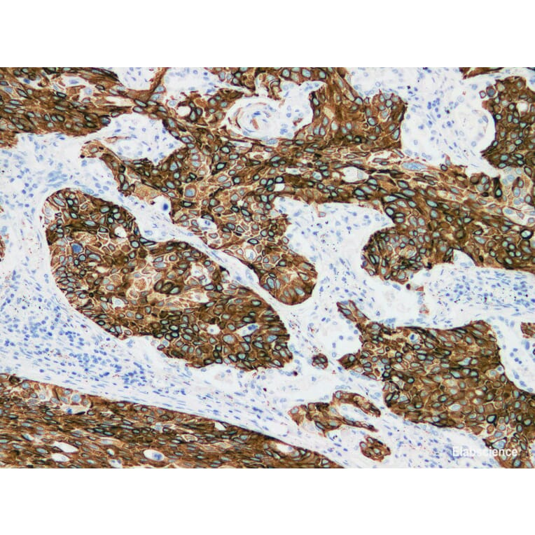 Validation Data - Anti-Cytokeratin 15 Antibody [YN00666m] (A288713)