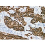 Validation Data - Anti-Cytokeratin 15 Antibody [YN00666m] (A288713)