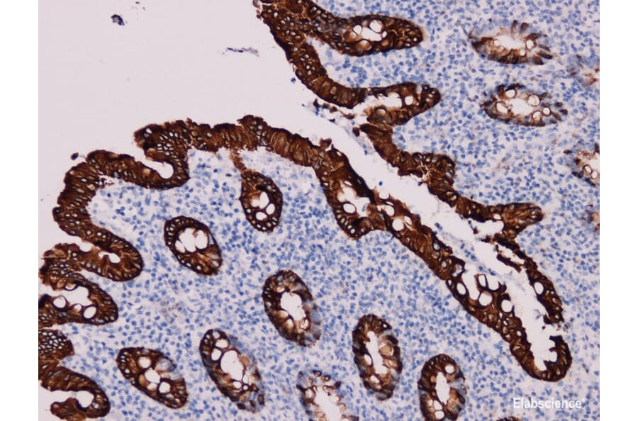Validation Data - Anti-Cytokeratin 20 Antibody [YN00715m] (A288714)