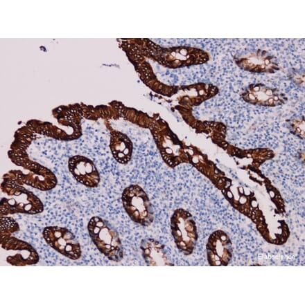 Validation Data - Anti-Cytokeratin 20 Antibody [YN00715m] (A288714)