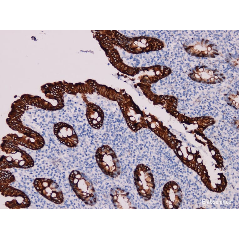 Validation Data - Anti-Cytokeratin 20 Antibody [YN00715m] (A288714)