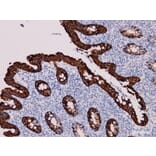 Validation Data - Anti-Cytokeratin 20 Antibody [YN00715m] (A288714)