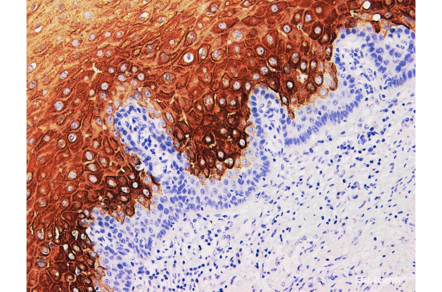 Validation Data - Anti-Cytokeratin 4 Antibody [YN01736m] (A288715)