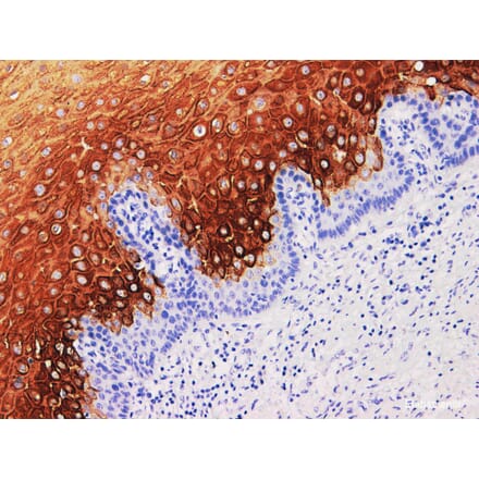 Validation Data - Anti-Cytokeratin 4 Antibody [YN01736m] (A288715)