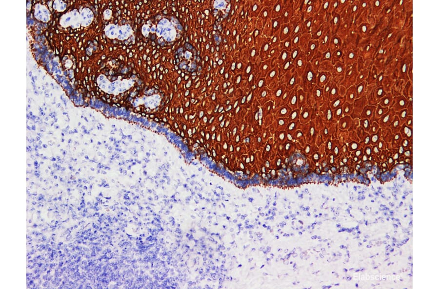 Validation Data - Anti-Cytokeratin 5/6 Antibody [YN00596r] (A288716)