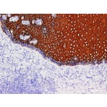 Validation Data - Anti-Cytokeratin 5/6 Antibody [YN00596r] (A288716)