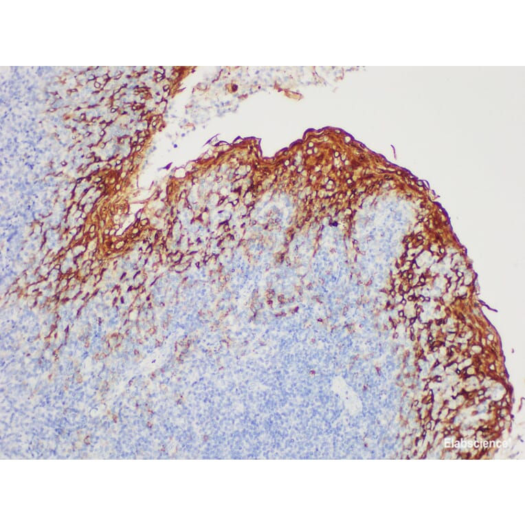 Validation Data - Anti-Epithelial Membrane Antigen(EMA) Antibody [YN00796m] (A288717)