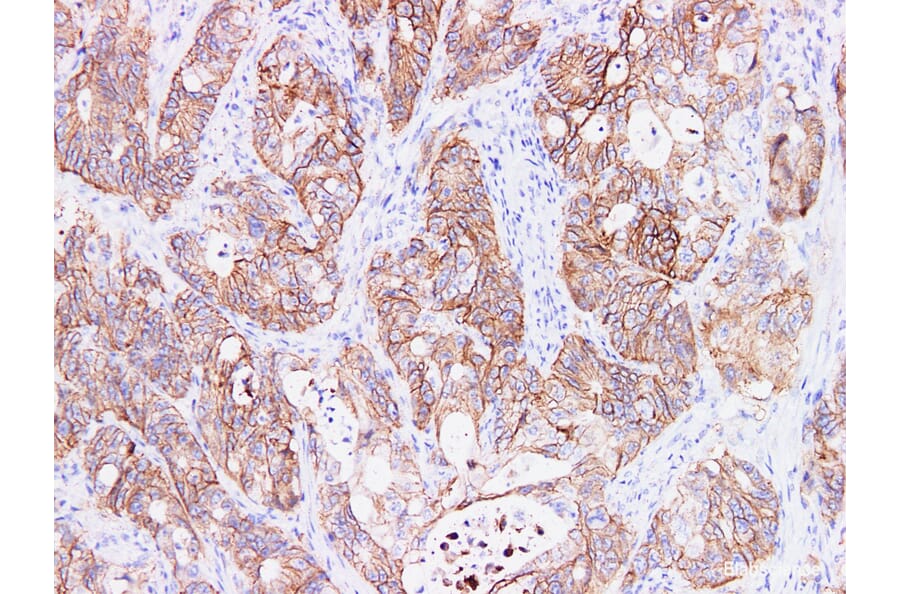 Validation Data - Anti-Ep-CAM Antibody [YN00785m] (A288718)