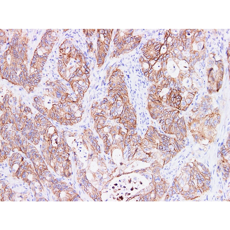 Validation Data - Anti-Ep-CAM Antibody [YN00785m] (A288718)