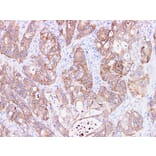 Validation Data - Anti-Ep-CAM Antibody [YN00785m] (A288718)
