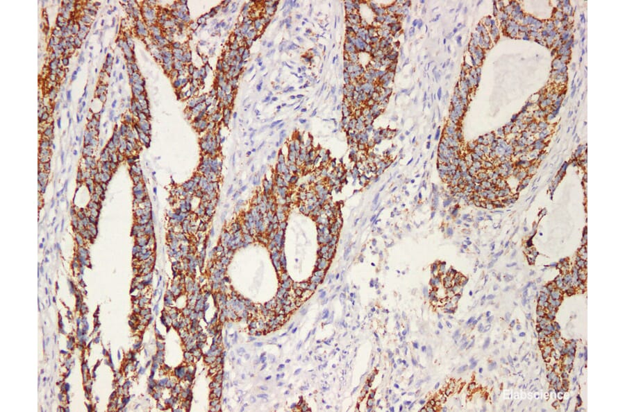 Validation Data - Anti-HSP60 Antibody [YN00966m] (A288720)