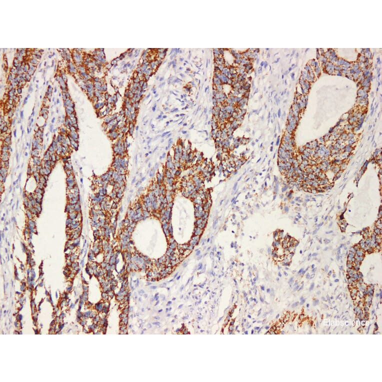 Validation Data - Anti-HSP60 Antibody [YN00966m] (A288720)