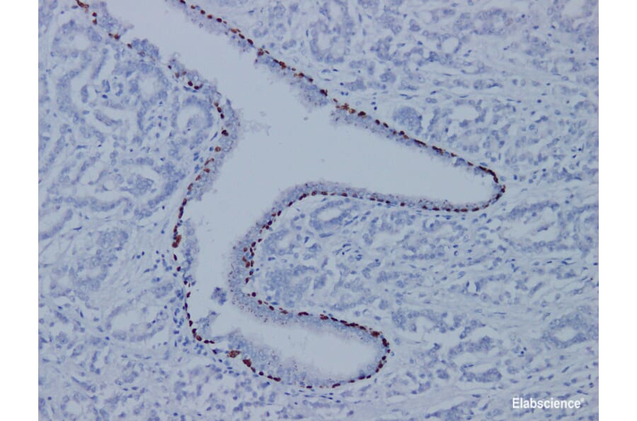 Validation Data - Anti-p63 Antibody [YN01255m] (A288721)