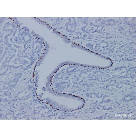 Validation Data - Anti-p63 Antibody [YN01255m] (A288721)