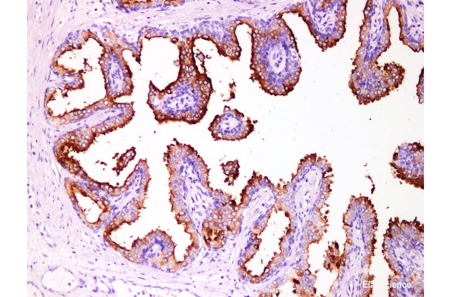 Validation Data - Anti-Prostate Specific Membrane Antigen (PSMA) Antibody [YN01406m] (A288722)