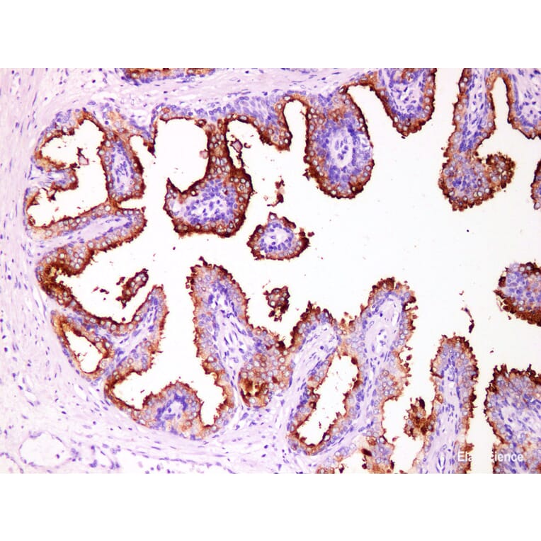 Validation Data - Anti-Prostate Specific Membrane Antigen (PSMA) Antibody [YN01406m] (A288722)