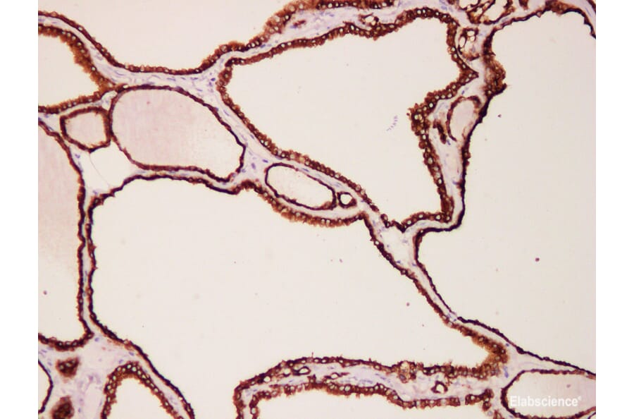 Validation Data - Anti-Thyroid Peroxidase(TPO) Antibody [YN01595m] (A288724)