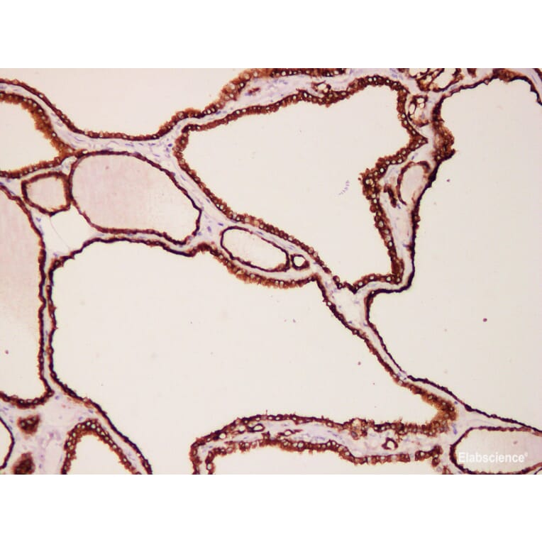 Validation Data - Anti-Thyroid Peroxidase(TPO) Antibody [YN01595m] (A288724)