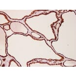 Validation Data - Anti-Thyroid Peroxidase(TPO) Antibody [YN01595m] (A288724)