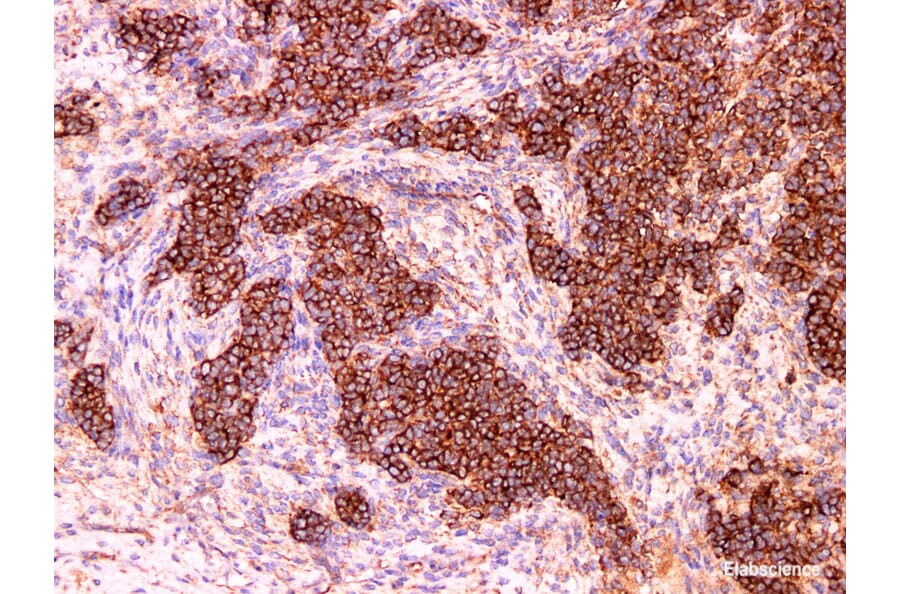 Validation Data - Anti-HDAC6 Antibody [YN00946m] (A288726)