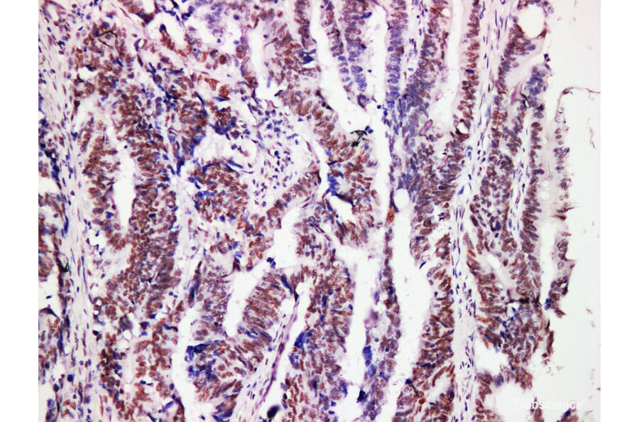 Validation Data - Anti-MutL Protein Homolog 1(MLH1) Antibody [YN01116m] (A288727)
