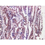 Validation Data - Anti-MutL Protein Homolog 1(MLH1) Antibody [YN01116m] (A288727)