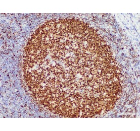 Validation Data - Anti-OCT2 Antibody [YN01216m] (A288728)