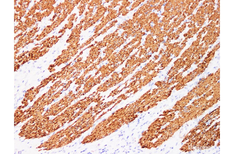 Validation Data - Anti-Actin muscle specific(MSA) Antibody [YN00016m] (A288729)