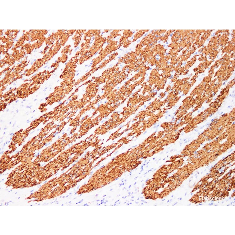 Validation Data - Anti-Actin muscle specific(MSA) Antibody [YN00016m] (A288729)