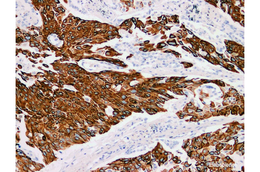 Validation Data - Anti-Cytokeratin 13 Antibody [YN00646m] (A288741)