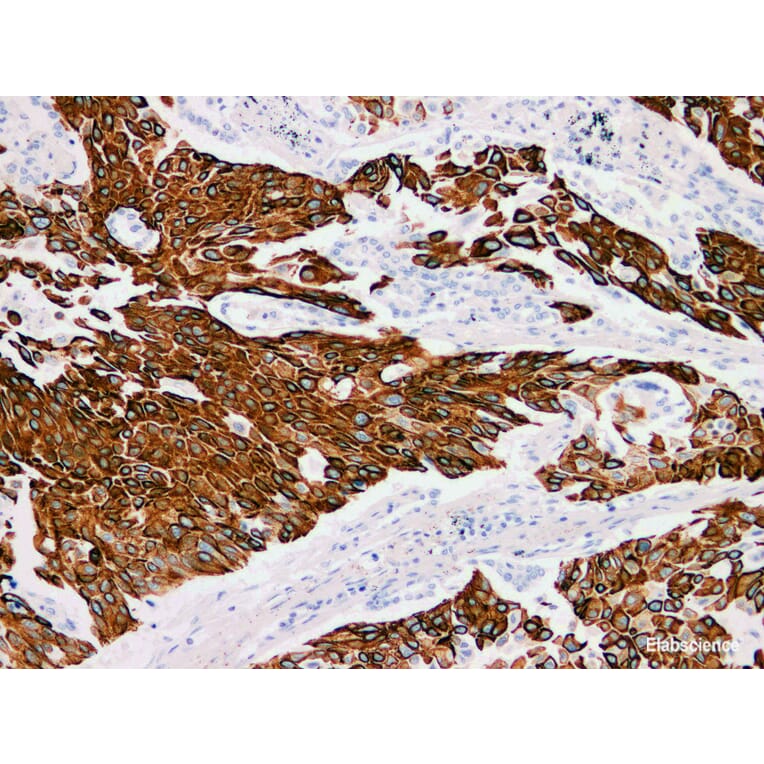 Validation Data - Anti-Cytokeratin 13 Antibody [YN00646m] (A288741)