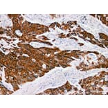 Validation Data - Anti-Cytokeratin 13 Antibody [YN00646m] (A288741)