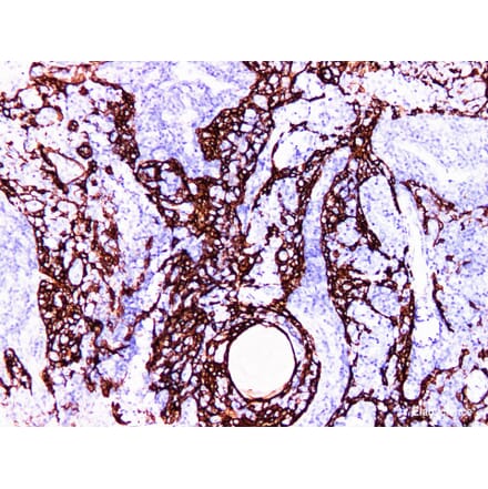 Validation Data - Anti-Cytokeratin 14 Antibody [YN00655m] (A288742)