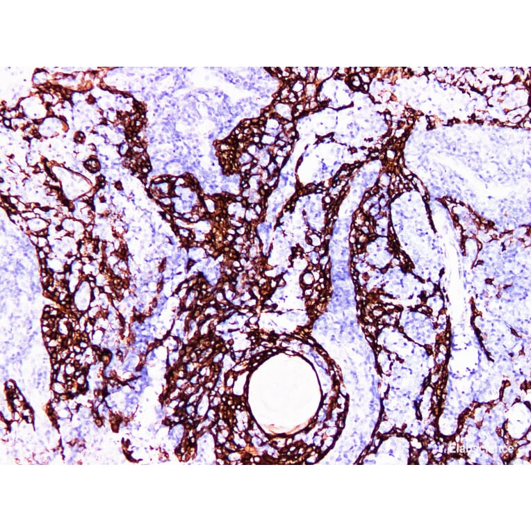 Validation Data - Anti-Cytokeratin 14 Antibody [YN00655m] (A288742)