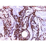 Validation Data - Anti-Cytokeratin 14 Antibody [YN00655m] (A288742)