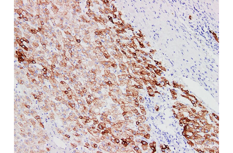 Validation Data - Anti-Cytokeratin 18 Antibody [YN00695m] (A288743)