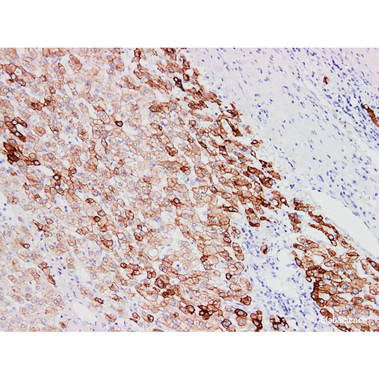 Validation Data - Anti-Cytokeratin 18 Antibody [YN00695m] (A288743)