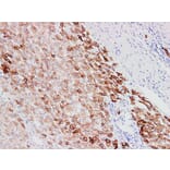 Validation Data - Anti-Cytokeratin 18 Antibody [YN00695m] (A288743)