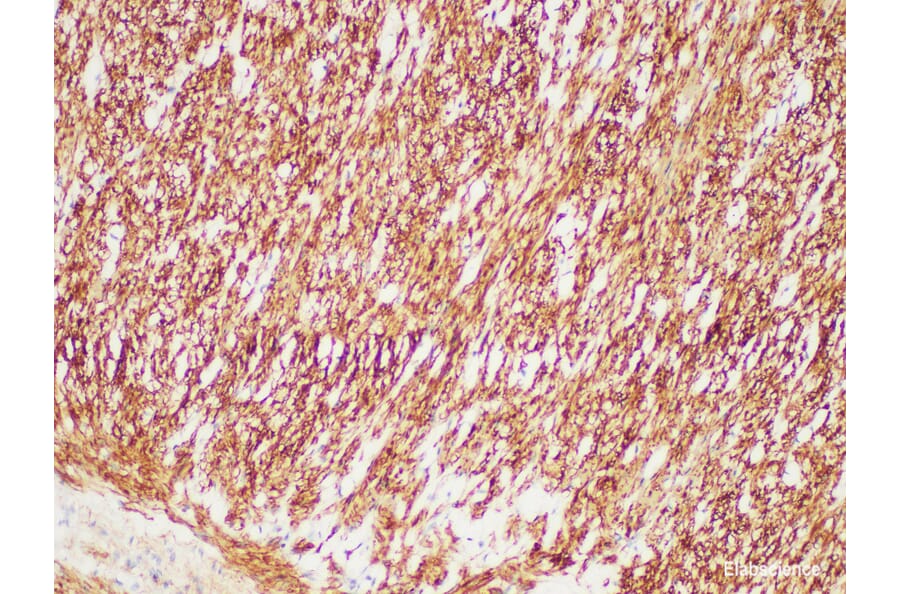 Validation Data - Anti-Desmin Antibody [YN00755m] (A288745)