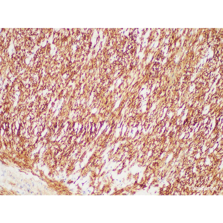 Validation Data - Anti-Desmin Antibody [YN00755m] (A288745)