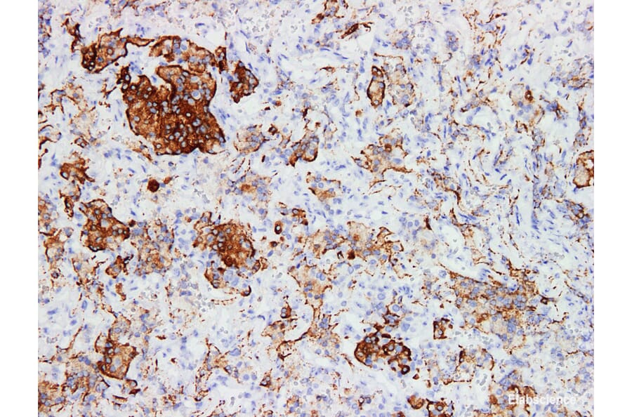 Validation Data - Anti-Human Growth Hormone(GH) Antibody [YN00916m] (A288747)