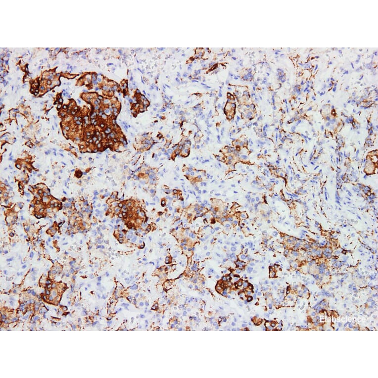 Validation Data - Anti-Human Growth Hormone(GH) Antibody [YN00916m] (A288747)