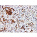 Validation Data - Anti-Human Growth Hormone(GH) Antibody [YN00916m] (A288747)