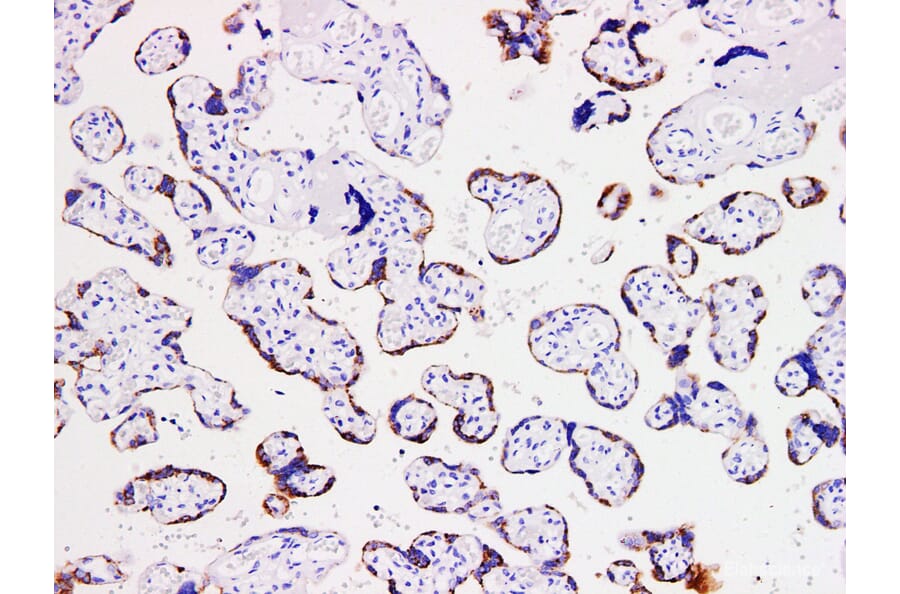 Validation Data - Anti-hCGß Antibody [YN00936m] (A288748)