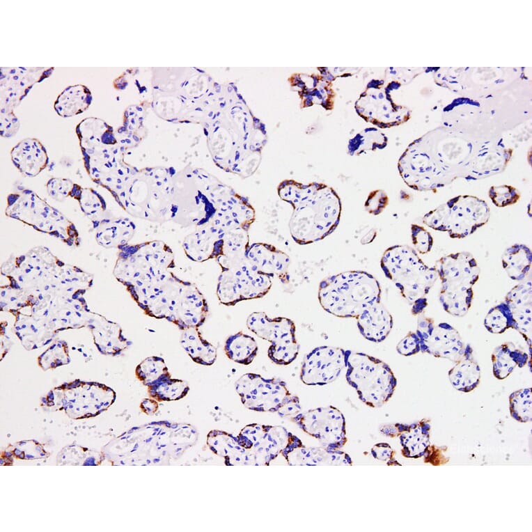 Validation Data - Anti-hCGß Antibody [YN00936m] (A288748)